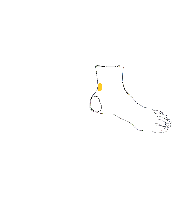 Lágyék. Bal belső