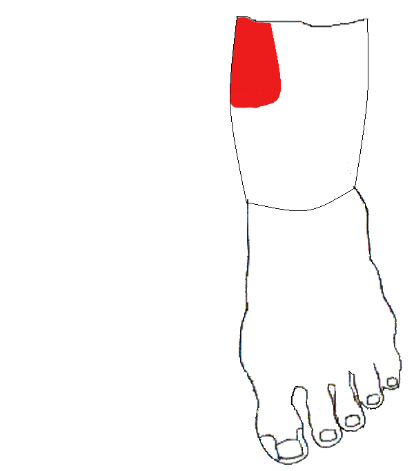 Vérnyomáscsökkentő