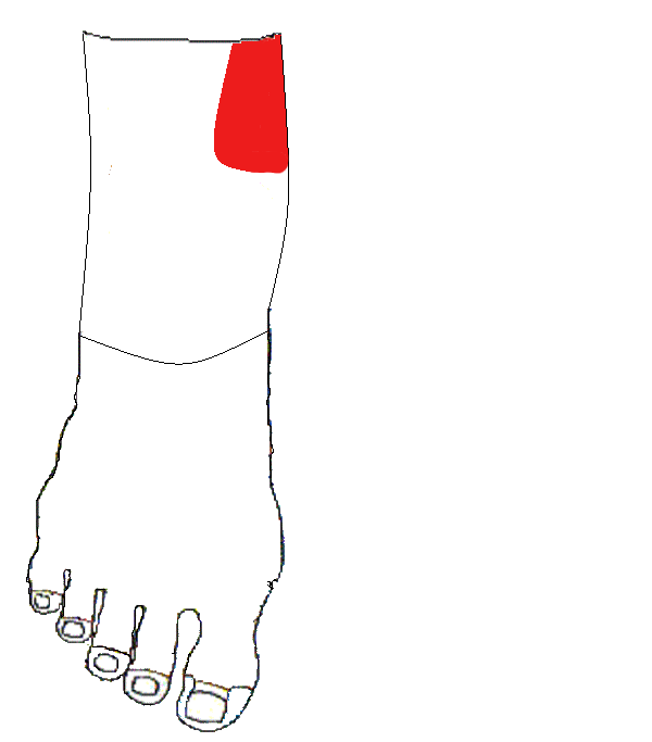 Vérnyomáscsökkentő