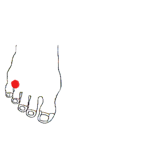 Vérnyomásemelő. Jobb lábfej