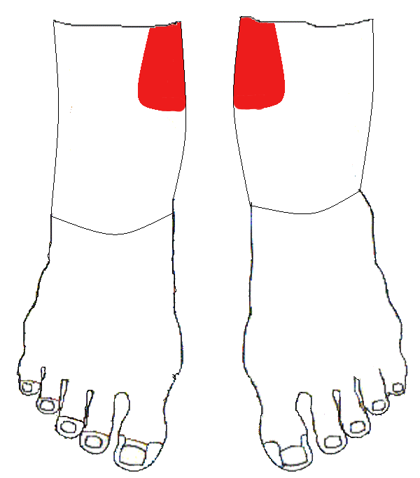 Vérnyomáscsökkentő